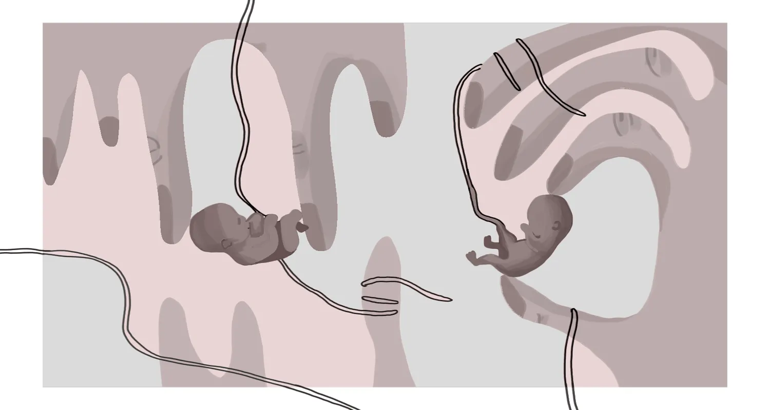 Ilustracja do tekstu