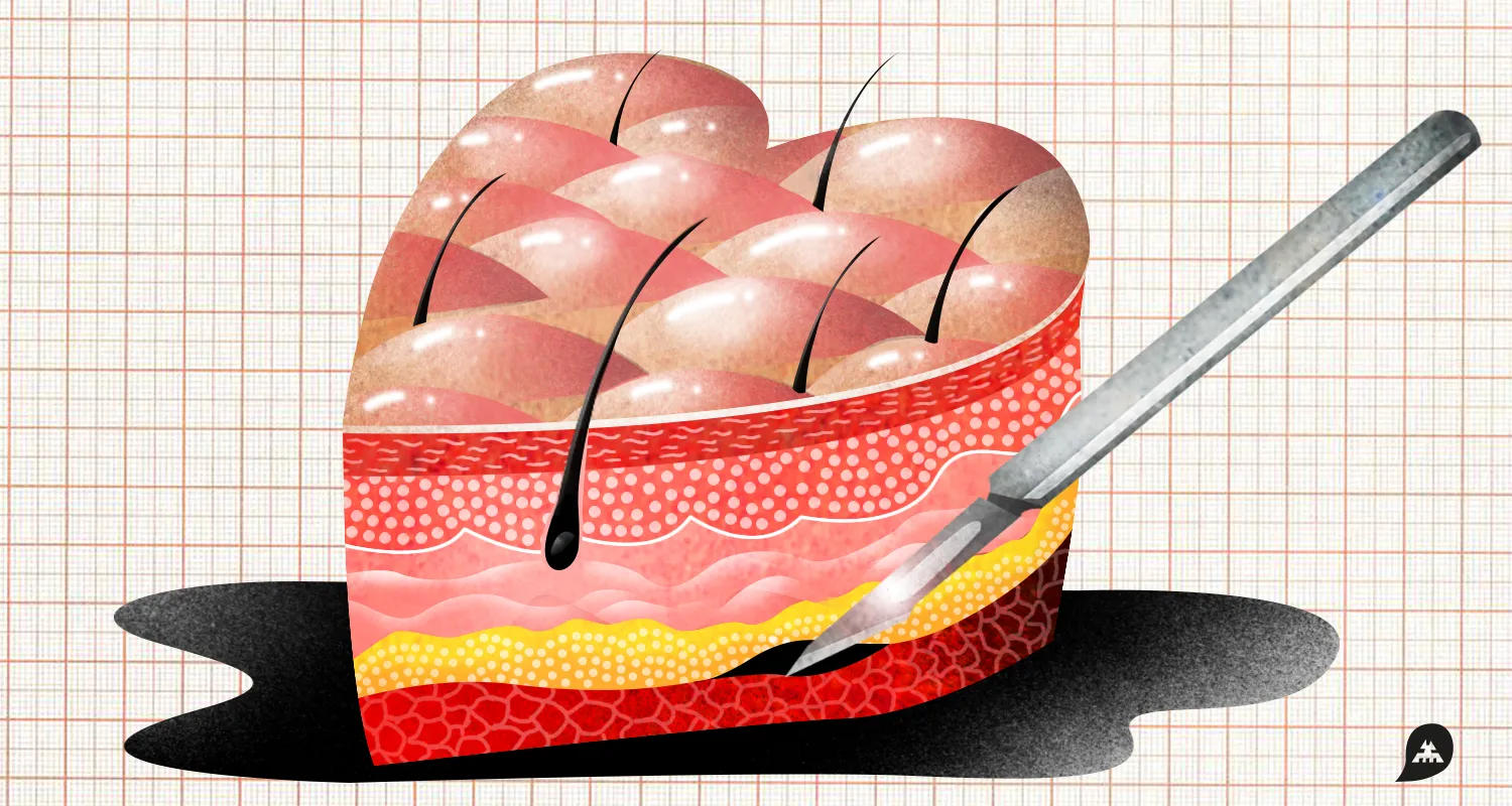 Ilustracja do tekstu